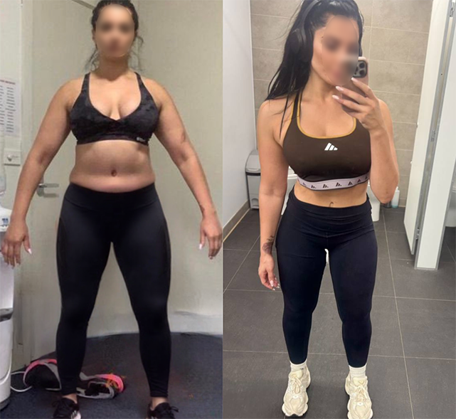 Alicia, 32 before and after